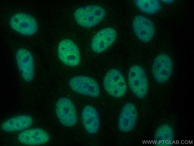 TFAP2A/AP-2 Antibody in Immunocytochemistry (ICC/IF)