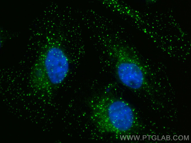 ZFYVE16 Antibody in Immunocytochemistry (ICC/IF)