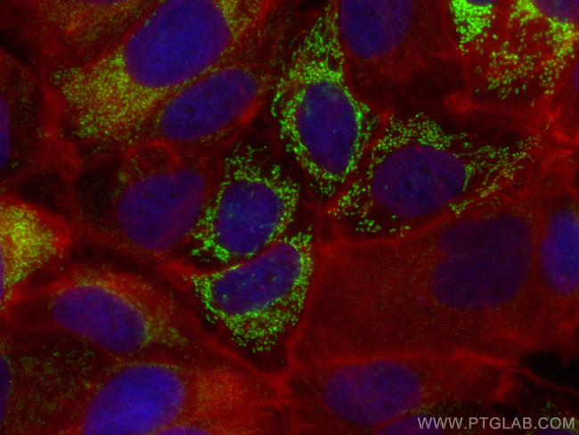 AK3L1 Antibody in Immunocytochemistry (ICC/IF)