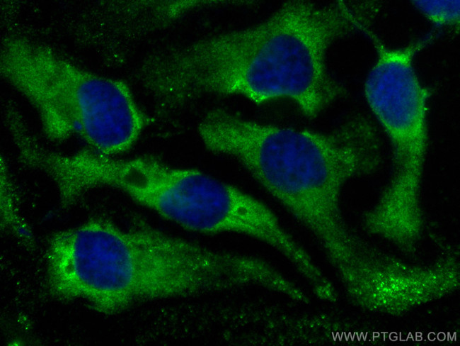 CSDE1 Antibody in Immunocytochemistry (ICC/IF)