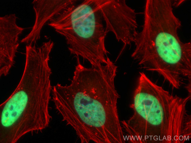 MCM6 Antibody in Immunocytochemistry (ICC/IF)