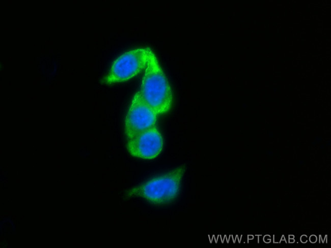 PPP1R12B Antibody in Immunocytochemistry (ICC/IF)