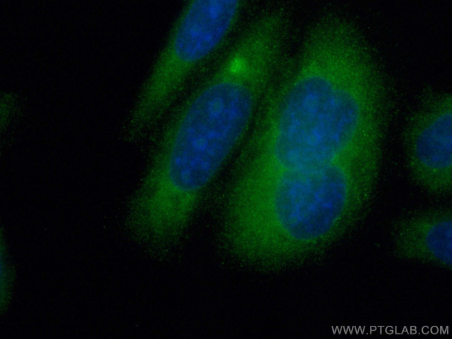 TFEB Antibody in Immunocytochemistry (ICC/IF)
