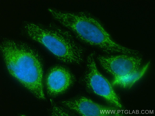 DLAT Antibody in Immunocytochemistry (ICC/IF)