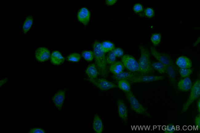 MTUS1 Antibody in Immunocytochemistry (ICC/IF)