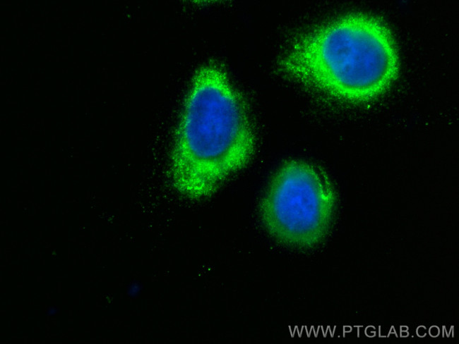 TNNC1 Antibody in Immunocytochemistry (ICC/IF)