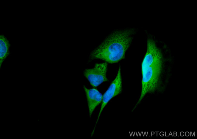 PRDX6 Antibody in Immunocytochemistry (ICC/IF)
