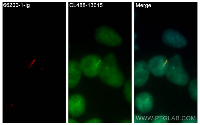 IFT20 Antibody in Immunocytochemistry (ICC/IF)