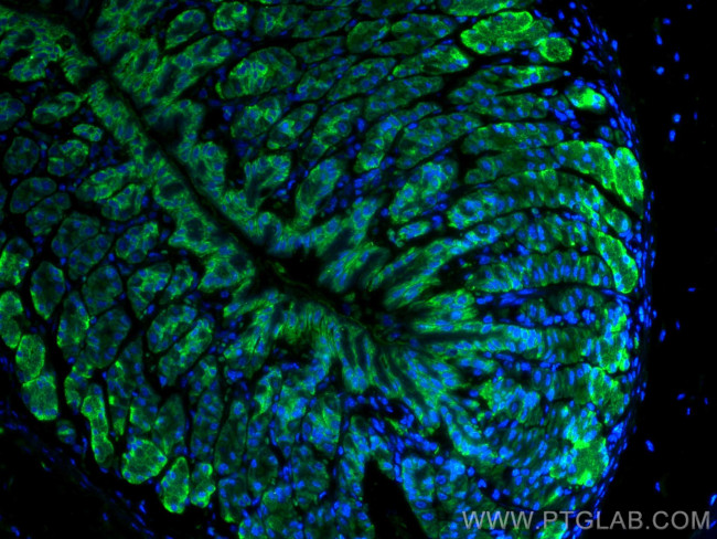 TFF2 Antibody in Immunohistochemistry (PFA fixed) (IHC (PFA))