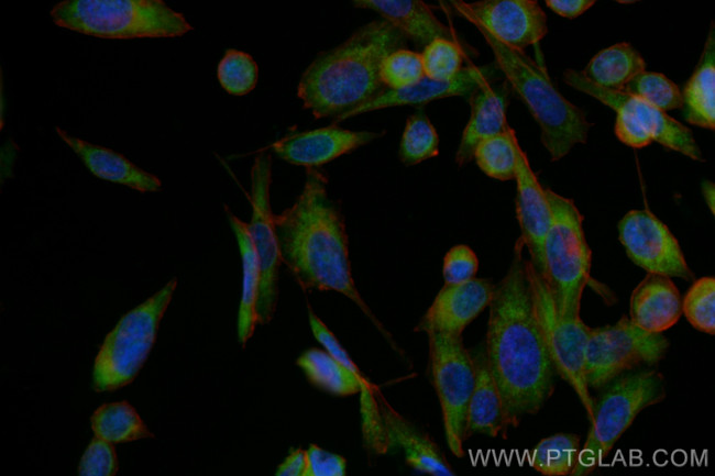 NEDD4L Antibody in Immunocytochemistry (ICC/IF)