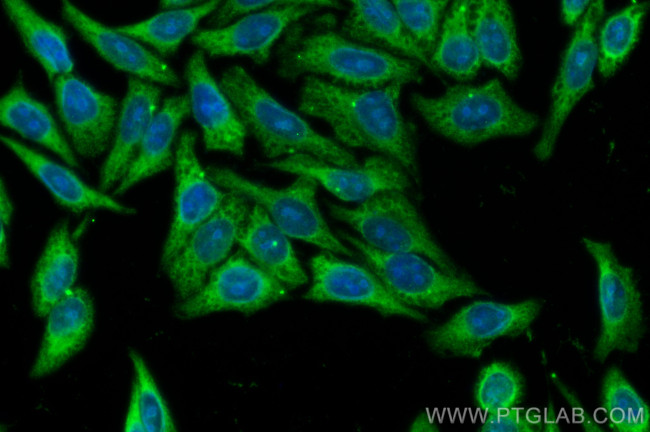 LARP1 Antibody in Immunocytochemistry (ICC/IF)