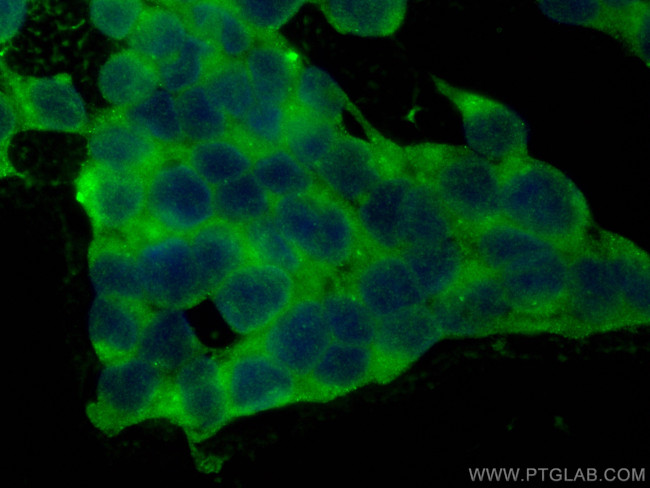 CaMKII alpha Antibody in Immunocytochemistry (ICC/IF)