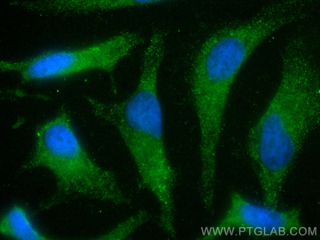 TRAK2 Antibody in Immunocytochemistry (ICC/IF)