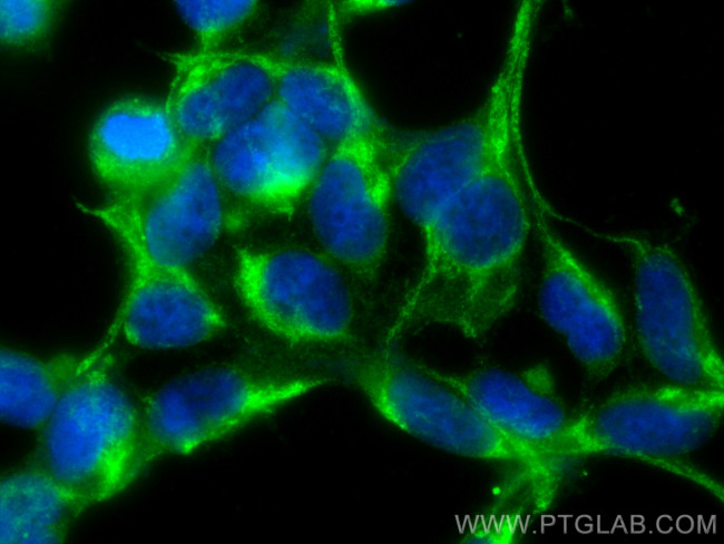 MFN1 Antibody in Immunocytochemistry (ICC/IF)