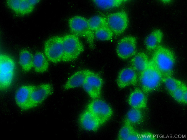 TAC1 Antibody in Immunocytochemistry (ICC/IF)