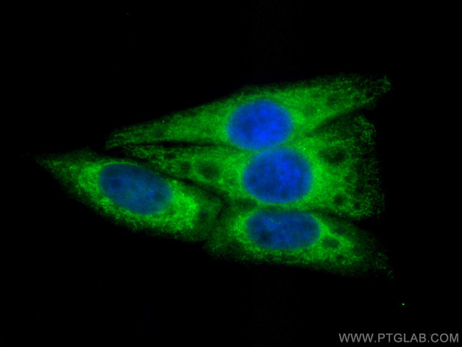 CCPG1 Antibody in Immunocytochemistry (ICC/IF)