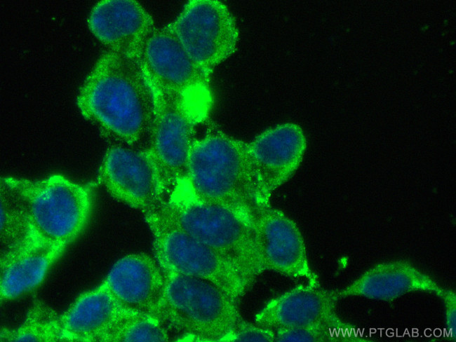 Synaptojanin 2 Antibody in Immunocytochemistry (ICC/IF)