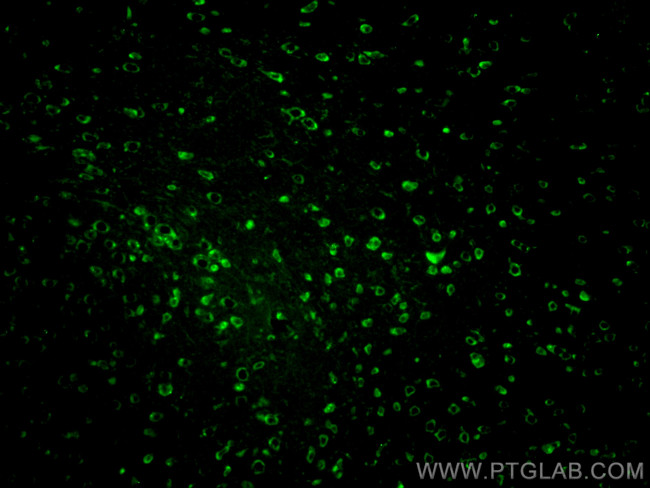 DCX Antibody in Immunohistochemistry (PFA fixed) (IHC (PFA))