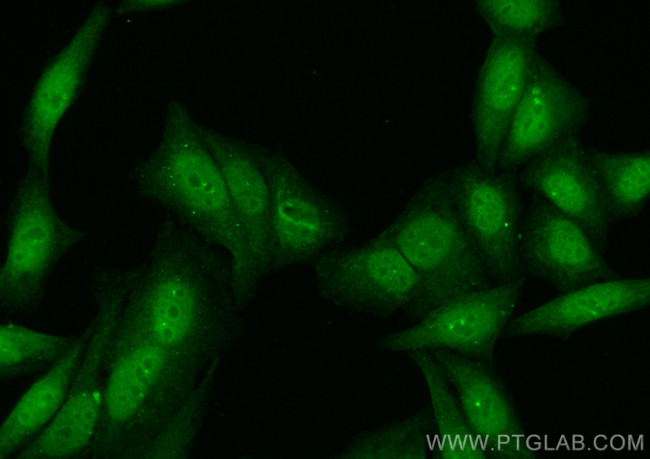 CHEK2 Antibody in Immunocytochemistry (ICC/IF)