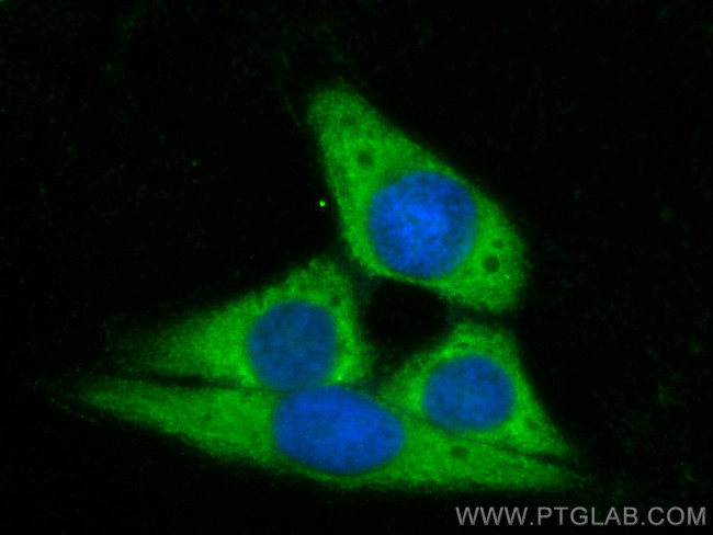 FATP2 Antibody in Immunocytochemistry (ICC/IF)