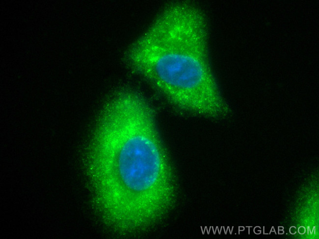 PDGF-D Antibody in Immunocytochemistry (ICC/IF)