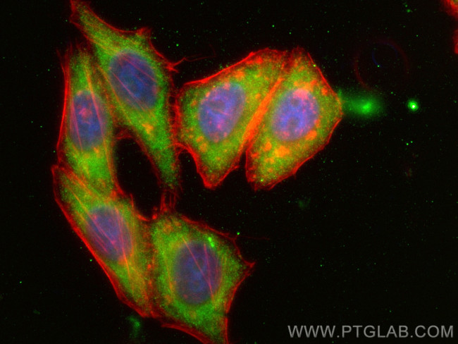 TPPII Antibody in Immunocytochemistry (ICC/IF)