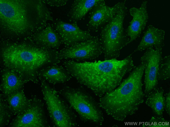 Talin-1 Antibody in Immunocytochemistry (ICC/IF)