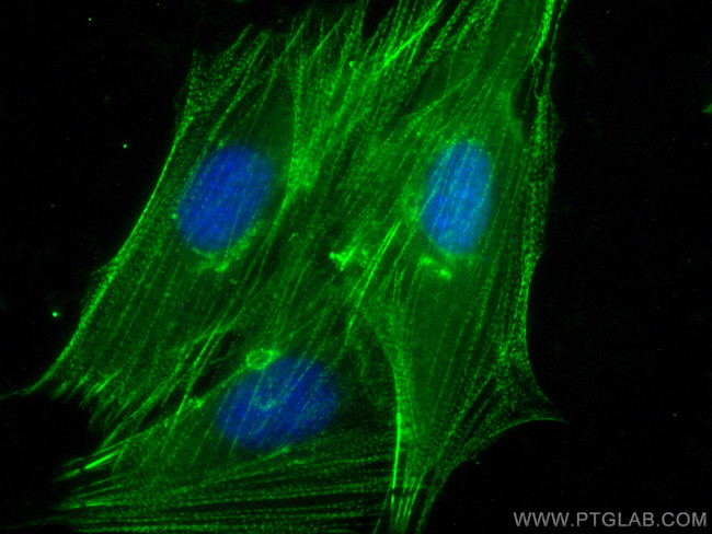 ACTN2 Antibody in Immunocytochemistry (ICC/IF)