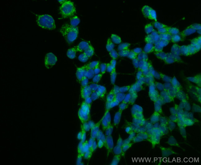 MMP19 Antibody in Immunocytochemistry (ICC/IF)