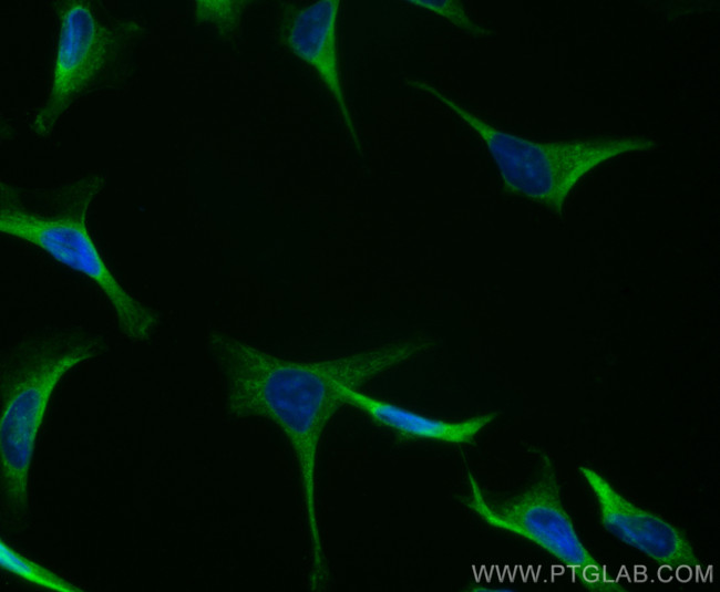 DIAPH3 Antibody in Immunocytochemistry (ICC/IF)