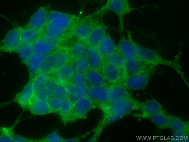 Alpha N-Catenin Antibody in Immunocytochemistry (ICC/IF)