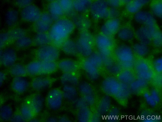 PIBF1 Antibody in Immunocytochemistry (ICC/IF)