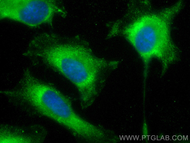 PARVB Antibody in Immunocytochemistry (ICC/IF)