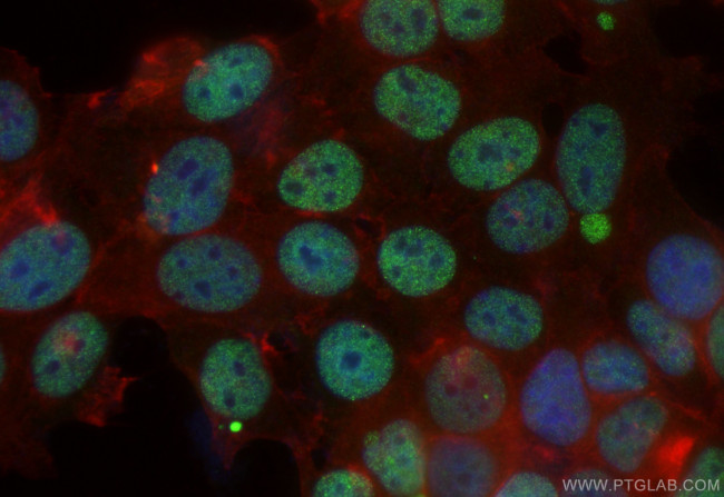 NAC1 Antibody in Immunocytochemistry (ICC/IF)