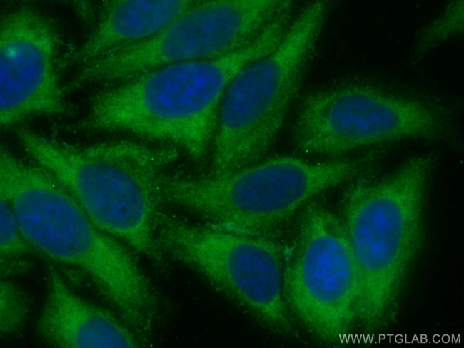 MMP14/MT1-MMP Antibody in Immunocytochemistry (ICC/IF)