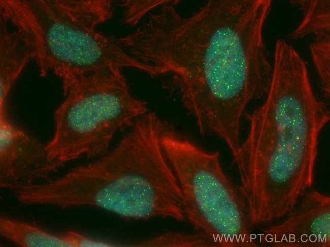 TERF2IP Antibody in Immunocytochemistry (ICC/IF)