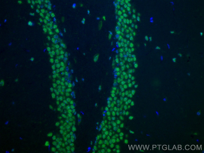BRN2 Antibody in Immunohistochemistry (PFA fixed) (IHC (PFA))