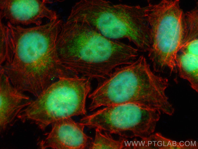 MAGEA6 Antibody in Immunocytochemistry (ICC/IF)