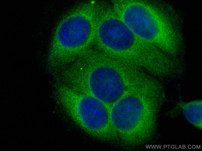 RABEP2 Antibody in Immunocytochemistry (ICC/IF)
