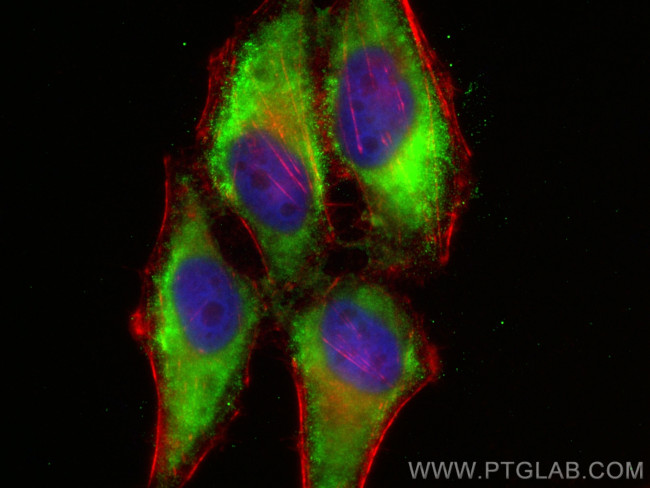 HPS4 Antibody in Immunocytochemistry (ICC/IF)