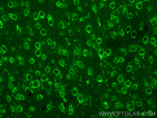 BIN1 Antibody in Immunohistochemistry (PFA fixed) (IHC (PFA))