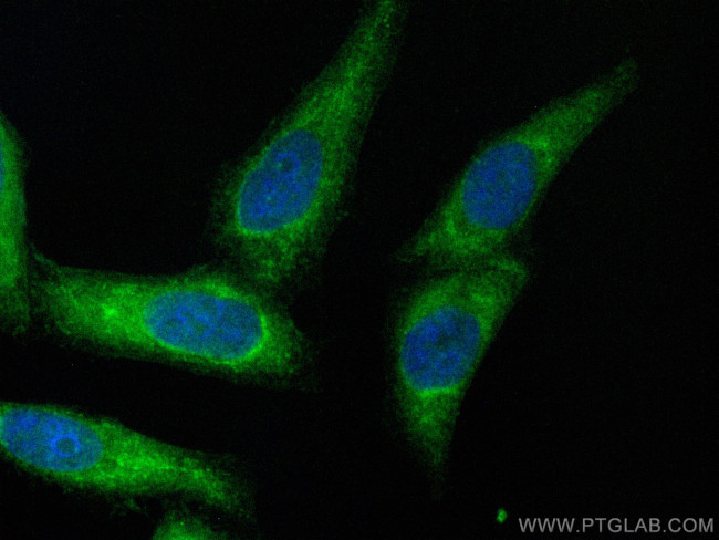 CRMP2 Antibody in Immunocytochemistry (ICC/IF)