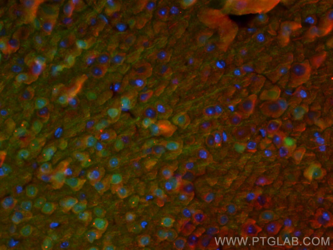 PCP4 Antibody in Immunohistochemistry (PFA fixed) (IHC (PFA))