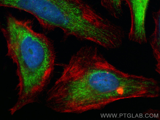 RNMTL1 Antibody in Immunocytochemistry (ICC/IF)