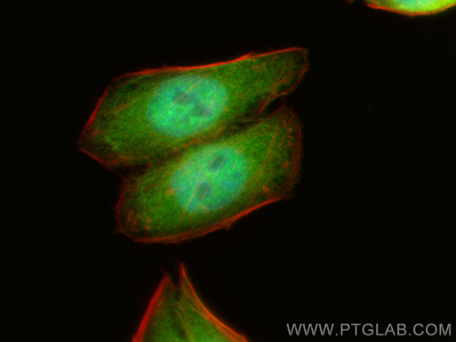 MGEA5 Antibody in Immunocytochemistry (ICC/IF)