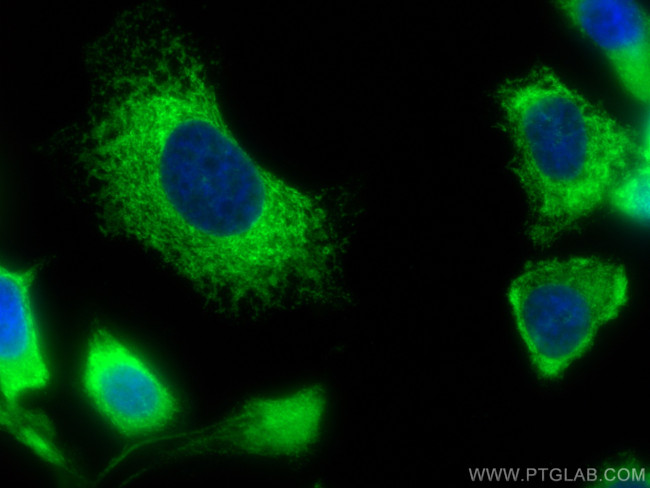 ERp72 Antibody in Immunocytochemistry (ICC/IF)