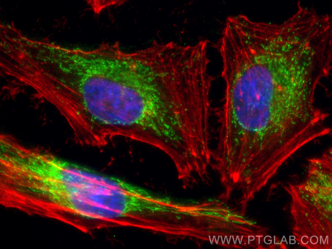 PDHB Antibody in Immunocytochemistry (ICC/IF)