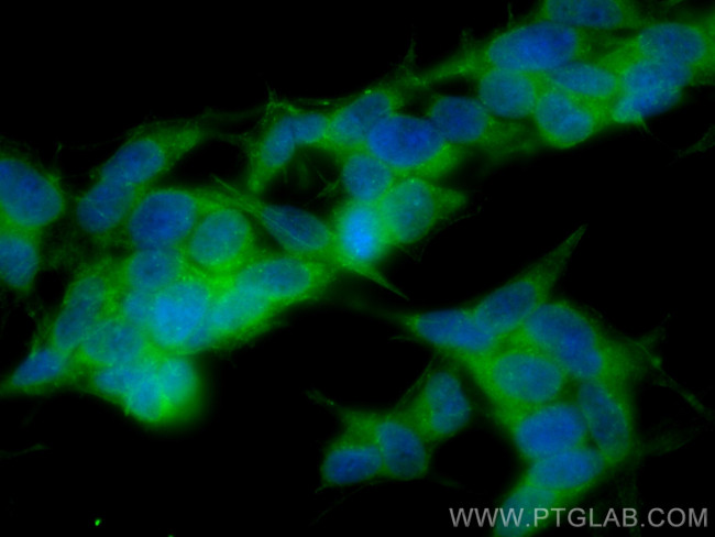 CORO1C Antibody in Immunocytochemistry (ICC/IF)