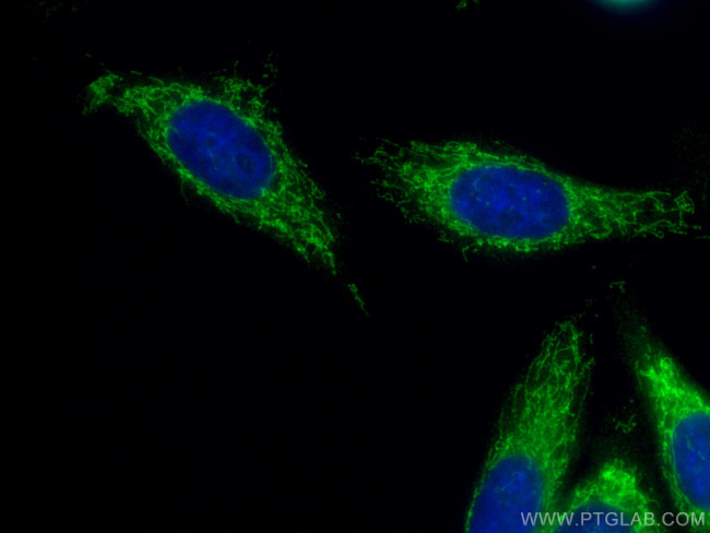 NDUFB8 Antibody in Immunocytochemistry (ICC/IF)