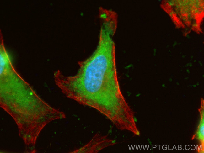 CRIP2 Antibody in Immunocytochemistry (ICC/IF)
